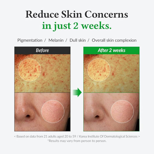 Gentle Vitamin C Serum 30ml Dr. Althea