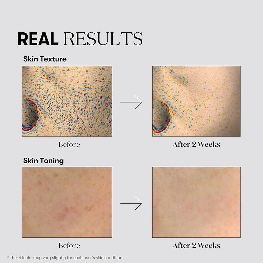 Tx-toning Essence 1000 Shot 30ML VTCOSMETICS